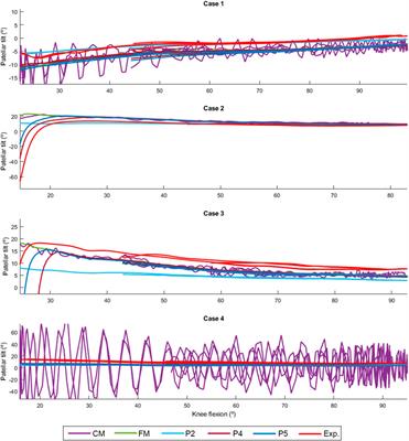 Use of patellofemoral digital twins for patellar tracking and treatment prediction: comparison of 3D models and contact detection algorithms